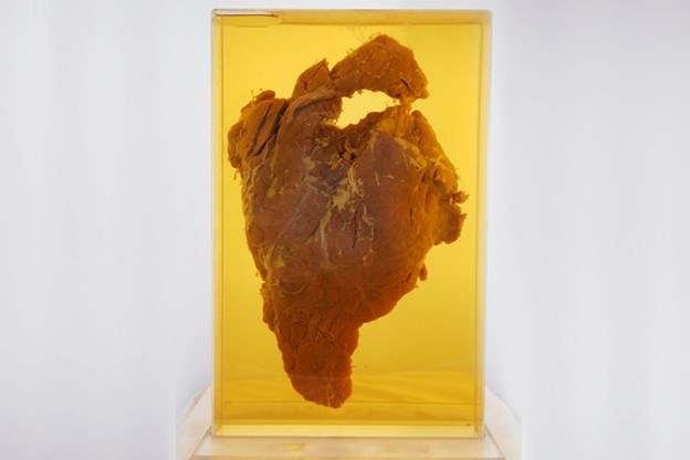 Giant preserved pancreas, grey background