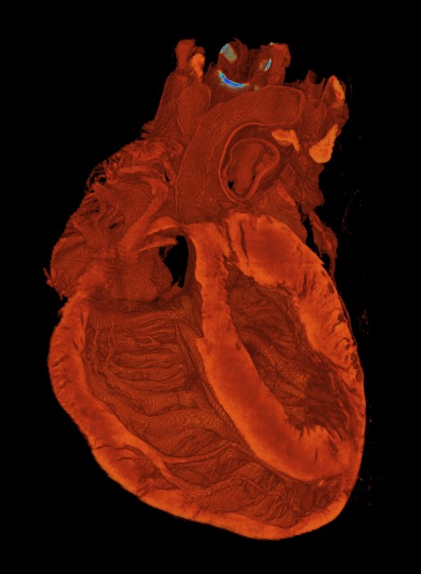 A Rat Heart