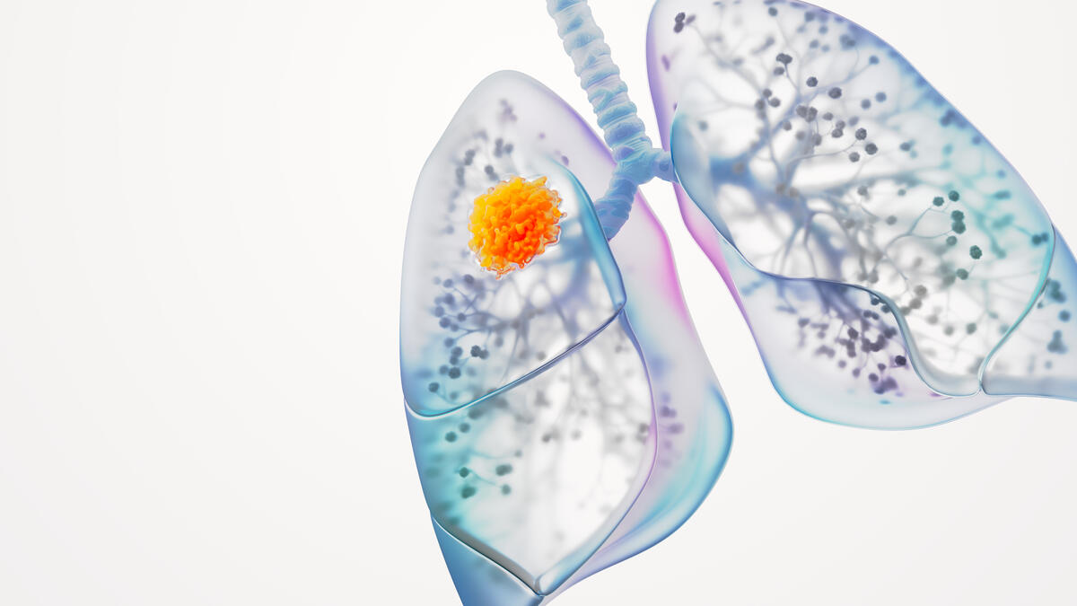 Lung Cancer Science Image RGB