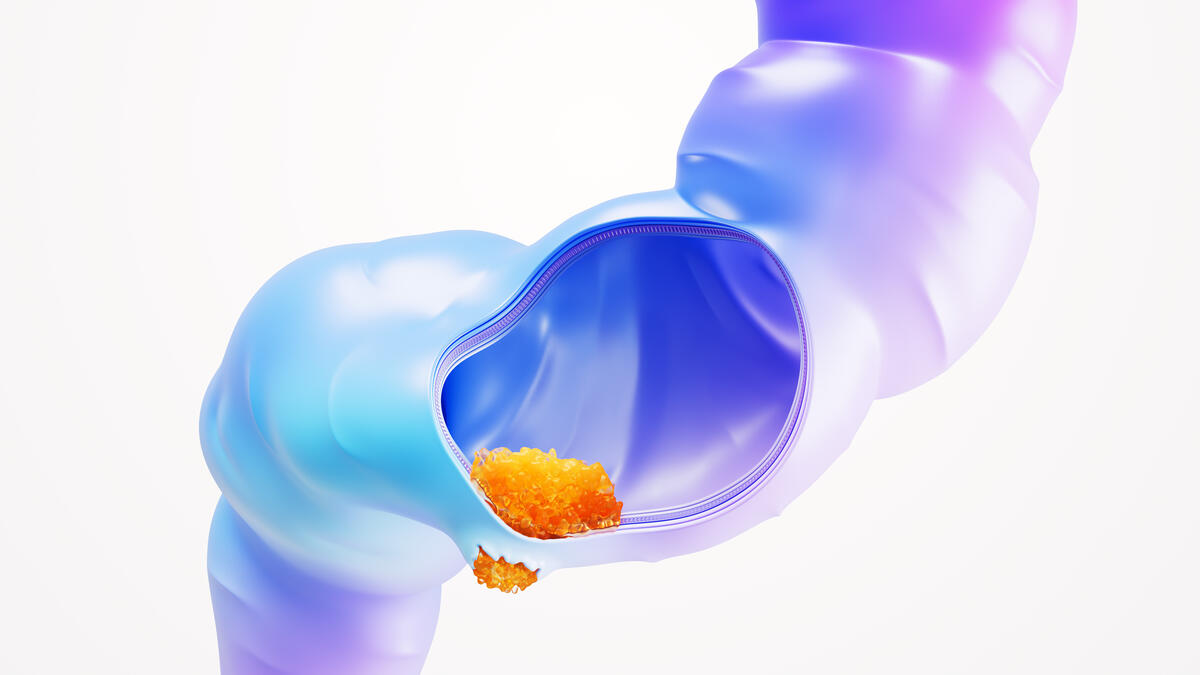 Colorectal Cancer Science Image