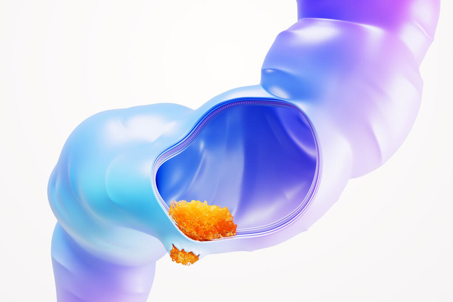 Colorectal Cancer Science Image