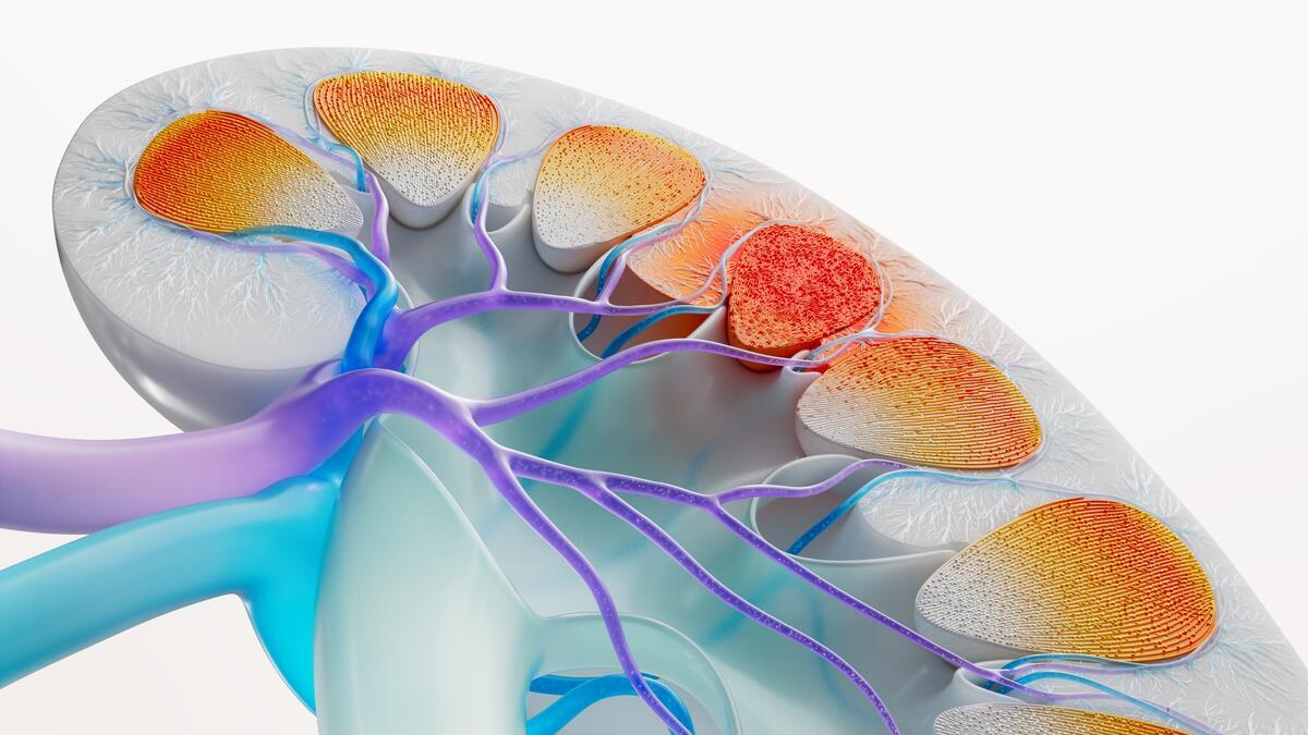 Lupus Nephritis (Kidney Disease) Science Image