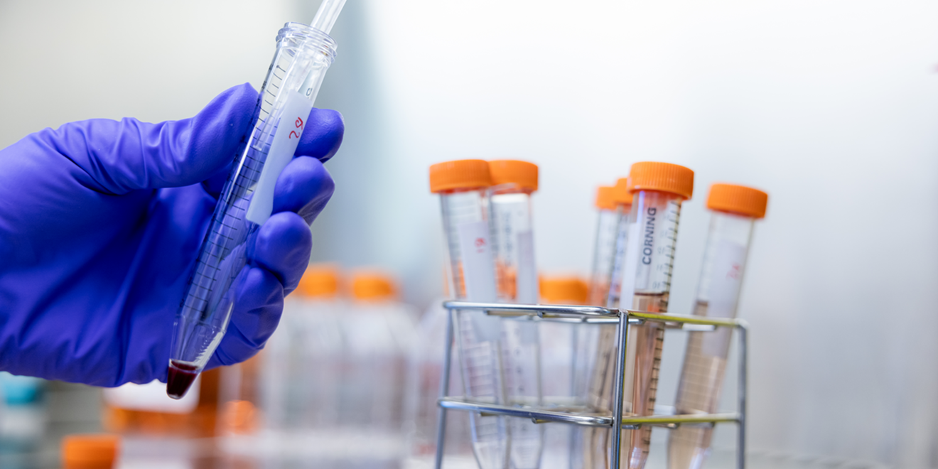 gloved hand filling a test tube