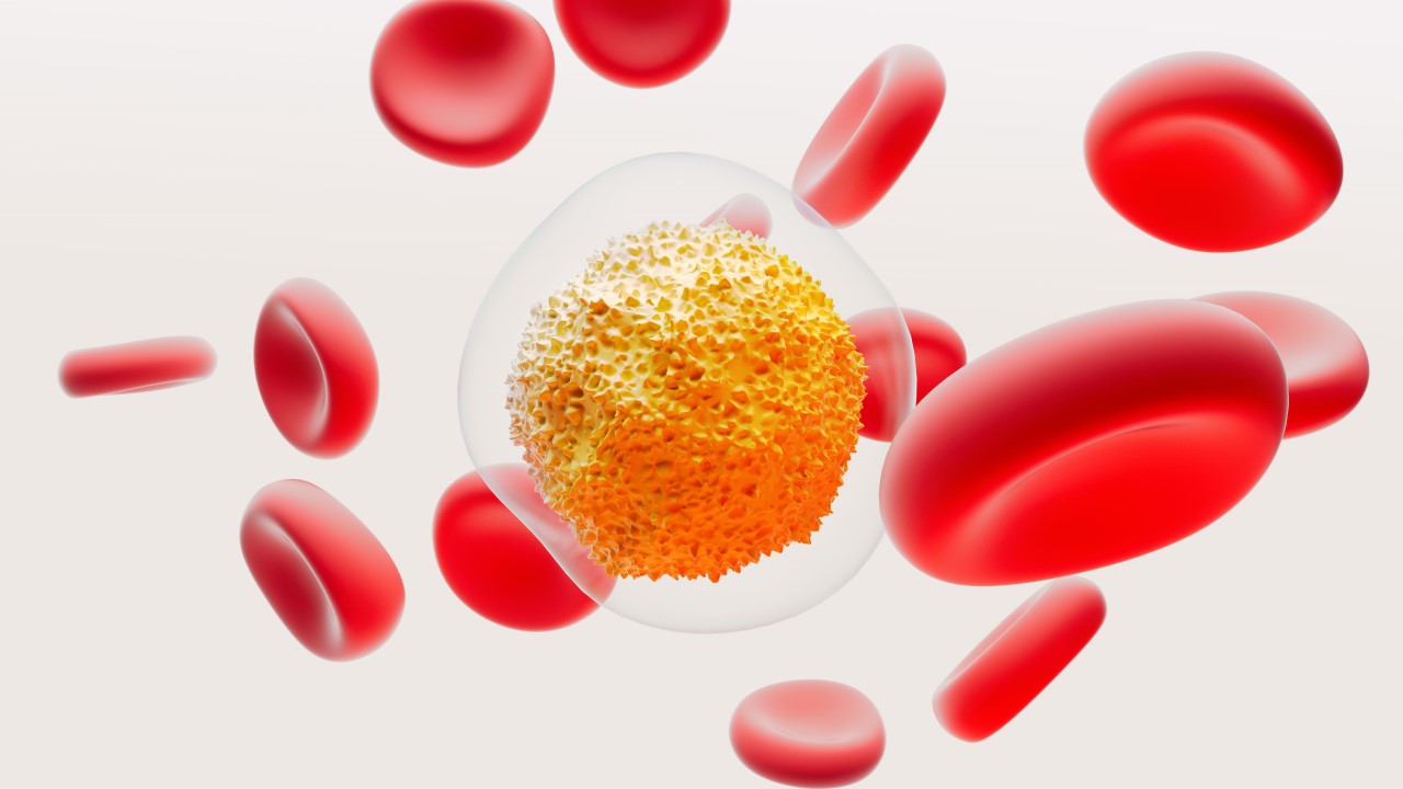 Multiple Myeloma cells