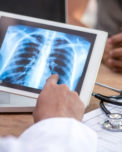 Person points to X-ray image of lungs