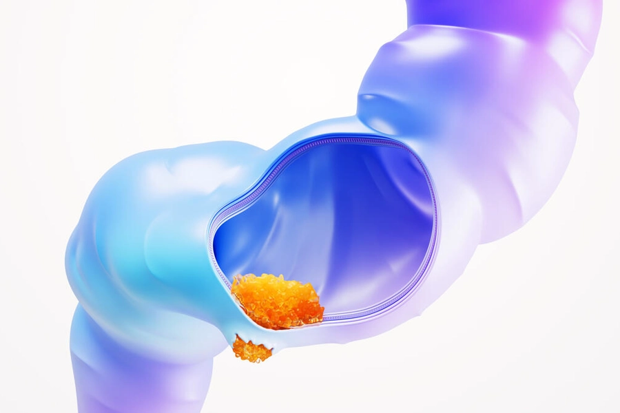 Colorectal Cancer Science Image